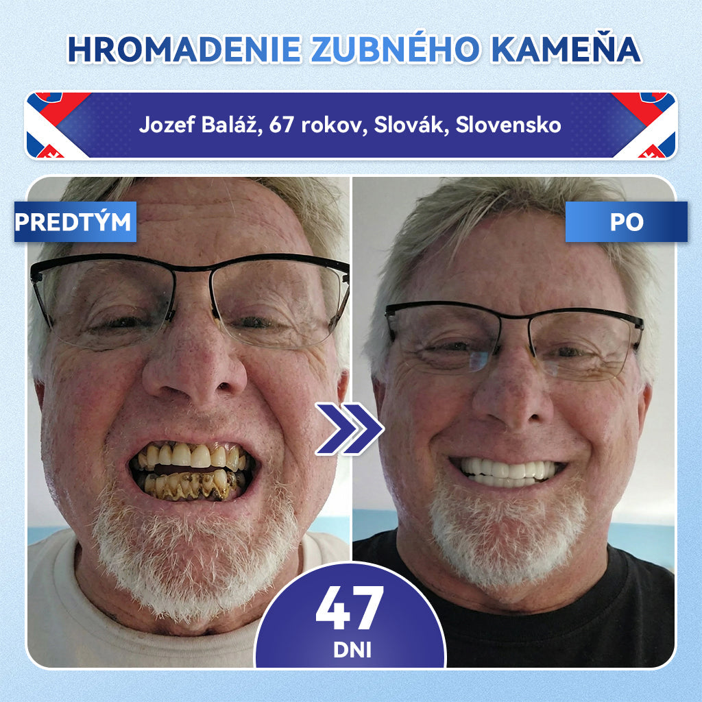 ✅𝐺𝑙𝑖𝑚𝑚𝑒𝑟𝑙𝑦®😁Tideglusib zuby a dasna Rýchlo rozpustné ústne pásiky Repair🦷🦷