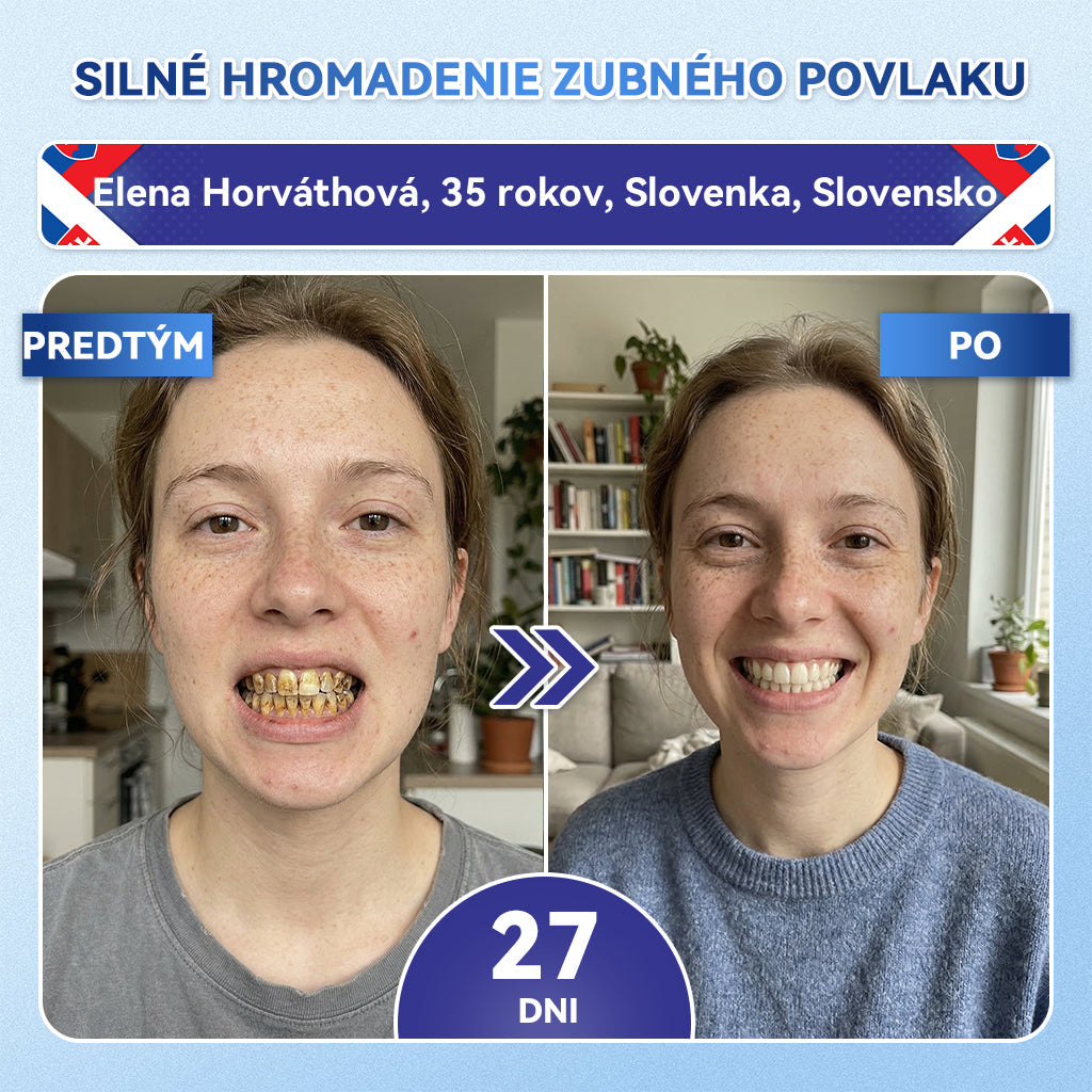 ✅𝐺𝑙𝑖𝑚𝑚𝑒𝑟𝑙𝑦®😁Tideglusib zuby a dasna Rýchlo rozpustné ústne pásiky Repair🦷🦷