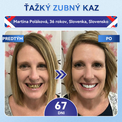 ✅𝐺𝑙𝑖𝑚𝑚𝑒𝑟𝑙𝑦®😁Tideglusib zuby a dasna Rýchlo rozpustné ústne pásiky Repair🦷🦷