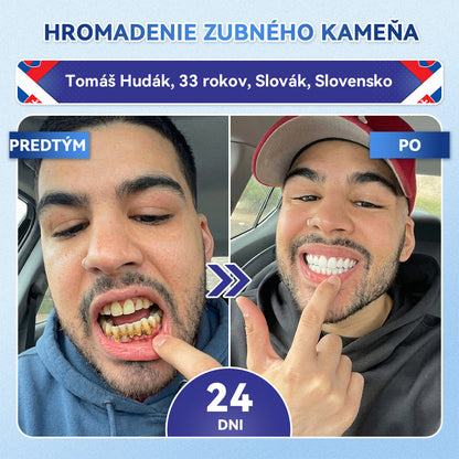 ✅𝐺𝑙𝑖𝑚𝑚𝑒𝑟𝑙𝑦®😁Tideglusib zuby a dasna Rýchlo rozpustné ústne pásiky Repair🦷🦷