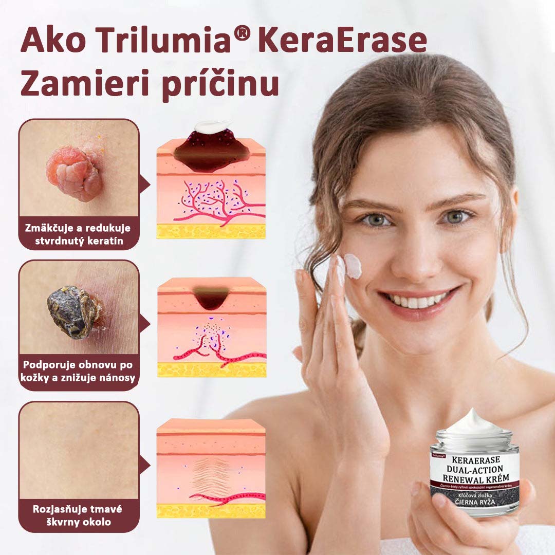 🔥🔥Trilumia®KeraErase regeneračný krém s dvojitým účinkom