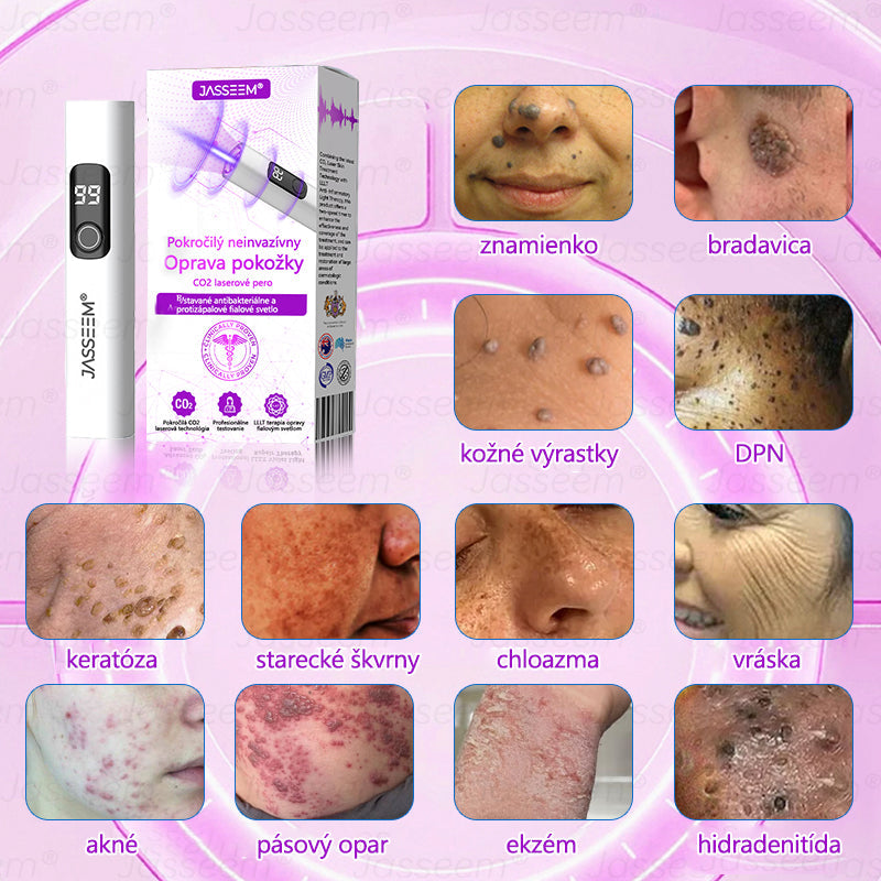 𝐉𝐚𝐬𝐬𝐞𝐞𝐦® Pokročilé neinvazívne CO₂ laserové pero na opravu pokožky 💕 (Jemne odstraňuje bradavice, materské znamienka, starecké škvrny a kožné výrastky – bez bolesti, bez starostí!)