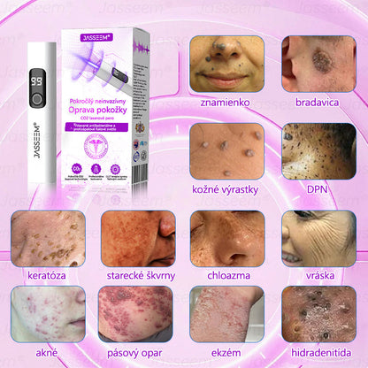 𝐉𝐚𝐬𝐬𝐞𝐞𝐦® Pokročilé neinvazívne CO₂ laserové pero na opravu pokožky 💕 (Jemne odstraňuje bradavice, materské znamienka, starecké škvrny a kožné výrastky – bez bolesti, bez starostí!)