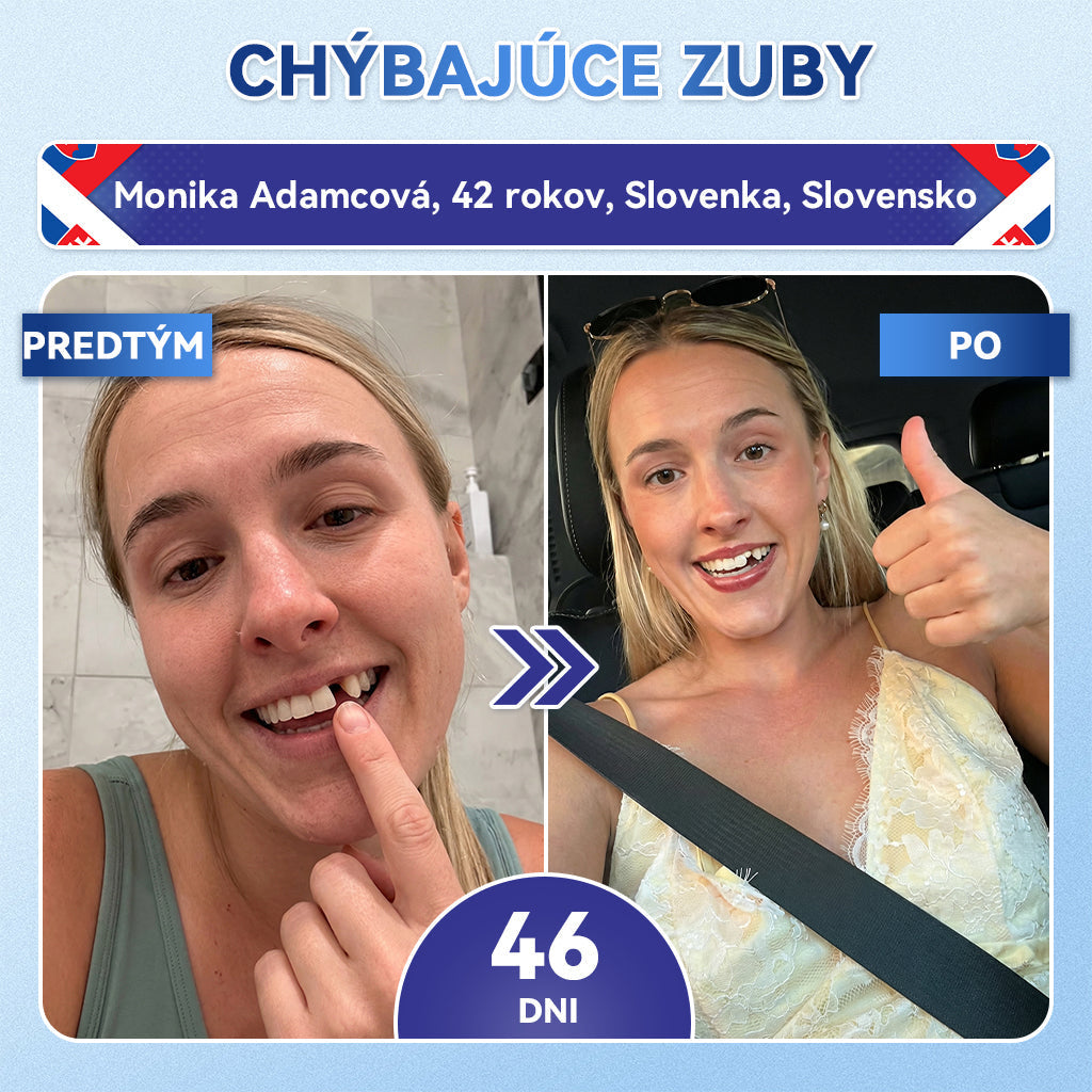 ✅𝐺𝑙𝑖𝑚𝑚𝑒𝑟𝑙𝑦®😁Tideglusib zuby a dasna Rýchlo rozpustné ústne pásiky Repair🦷🦷