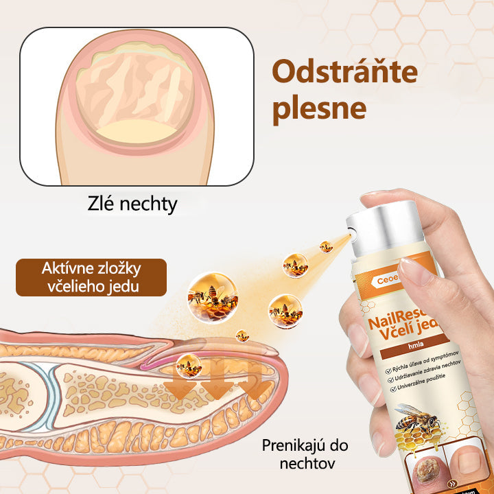 2026🎁 Limitovaná akcia 70% ZĽAVA ️ ️⏳ Ceoerty® Sprej na nechtovú hubu s včelím jedom 💥 Oprava všetkých problémov s nechtami do 2 týždňov