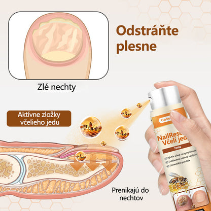 2026🎁 Limitovaná akcia 70% ZĽAVA ️ ️⏳ Ceoerty® Sprej na nechtovú hubu s včelím jedom 💥 Oprava všetkých problémov s nechtami do 2 týždňov