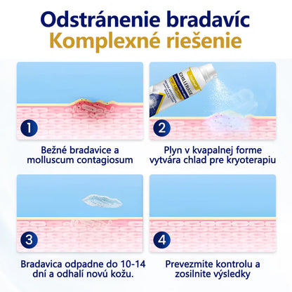 ❄️Foulme® ChillErase obnovujúci sprej proti kožným výrastkom