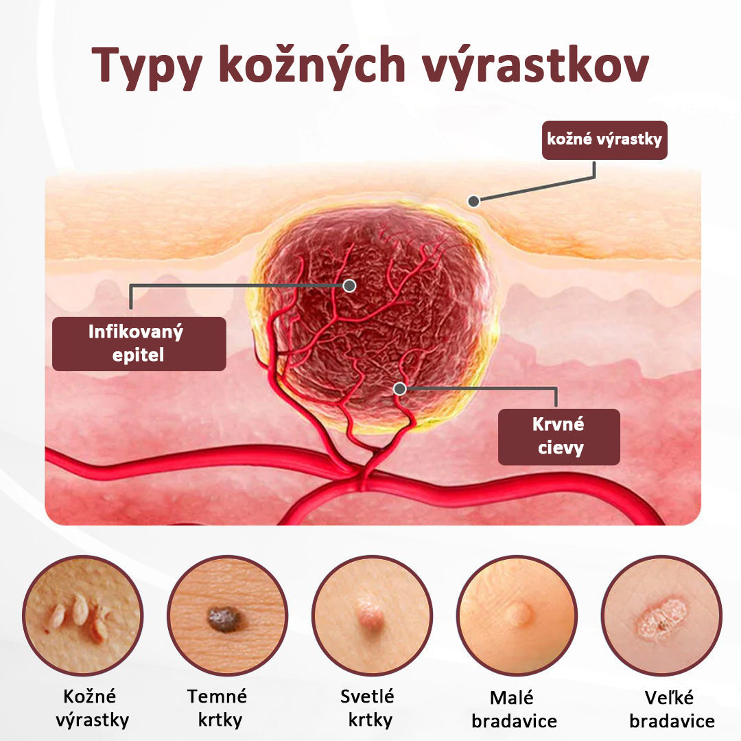 🔥🔥Trilumia®KeraErase regeneračný krém s dvojitým účinkom