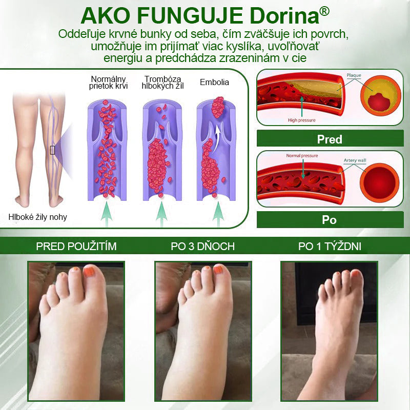 🌿🌿🌿Dorina® Bylinný krém na zmiernenie opuchov s čiernou rascou.