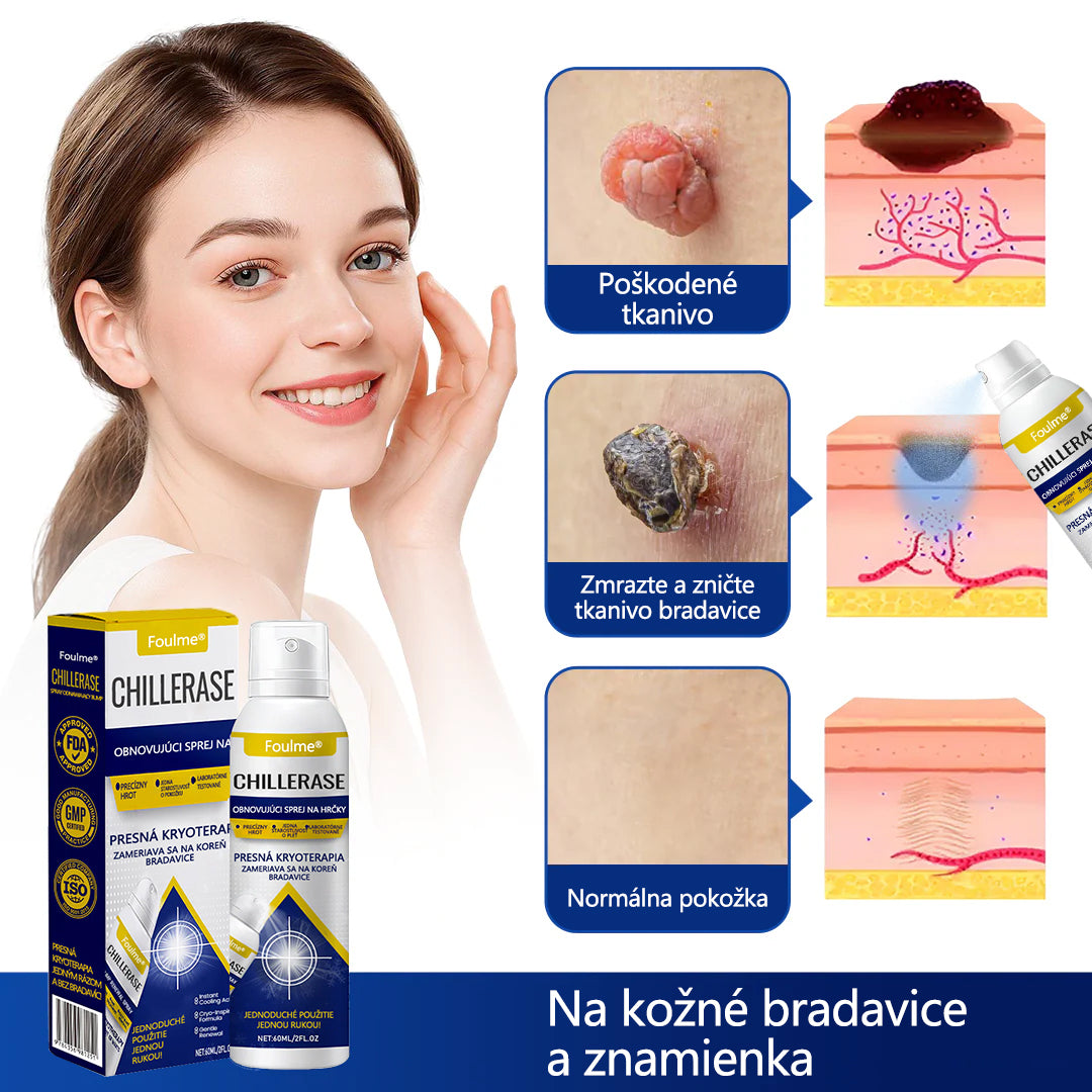 ❄️Foulme® ChillErase obnovujúci sprej proti kožným výrastkom