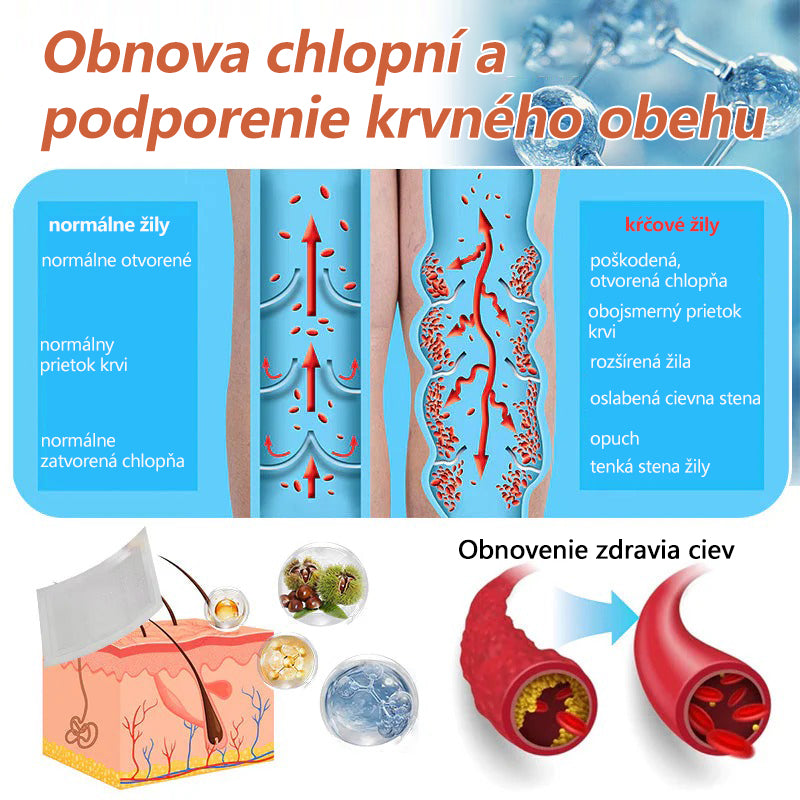 ☘️ Zvoevo® Vein Ease mikroihličková terapia (na metličkové žilky, kŕčové žily, opuchy nôh a únavu nôh)