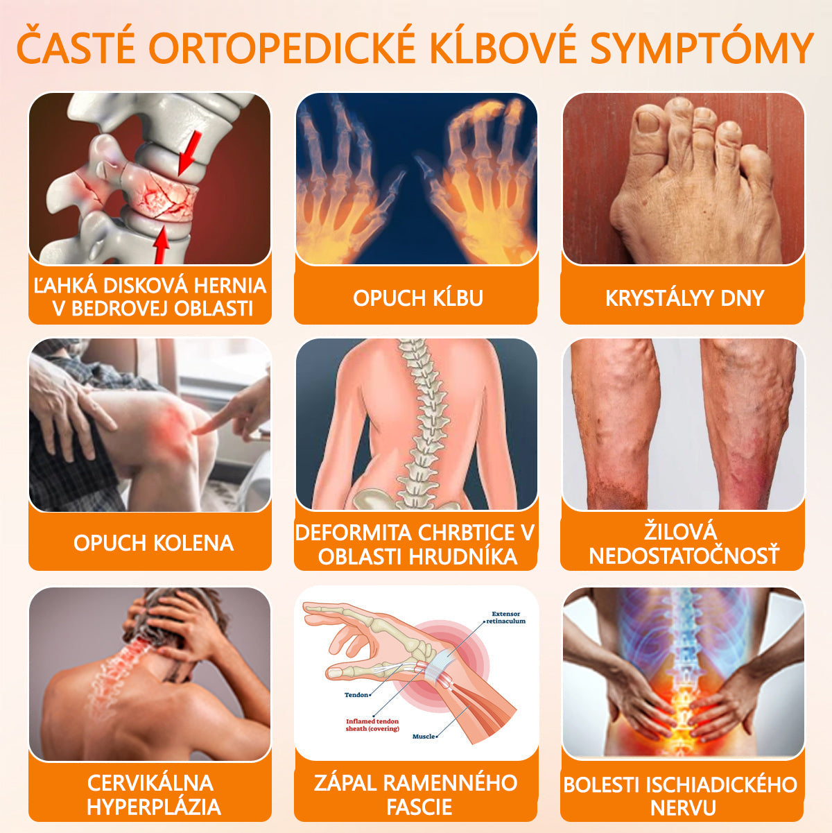 Foulme® Krém na hojenie kostí s botulotoxínom a včelím jedom ⭐👨‍⚕️
