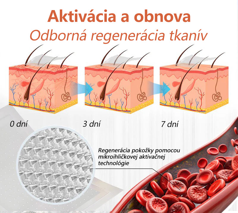 ☘️ Zvoevo® Vein Ease mikroihličková terapia (na metličkové žilky, kŕčové žily, opuchy nôh a únavu nôh)